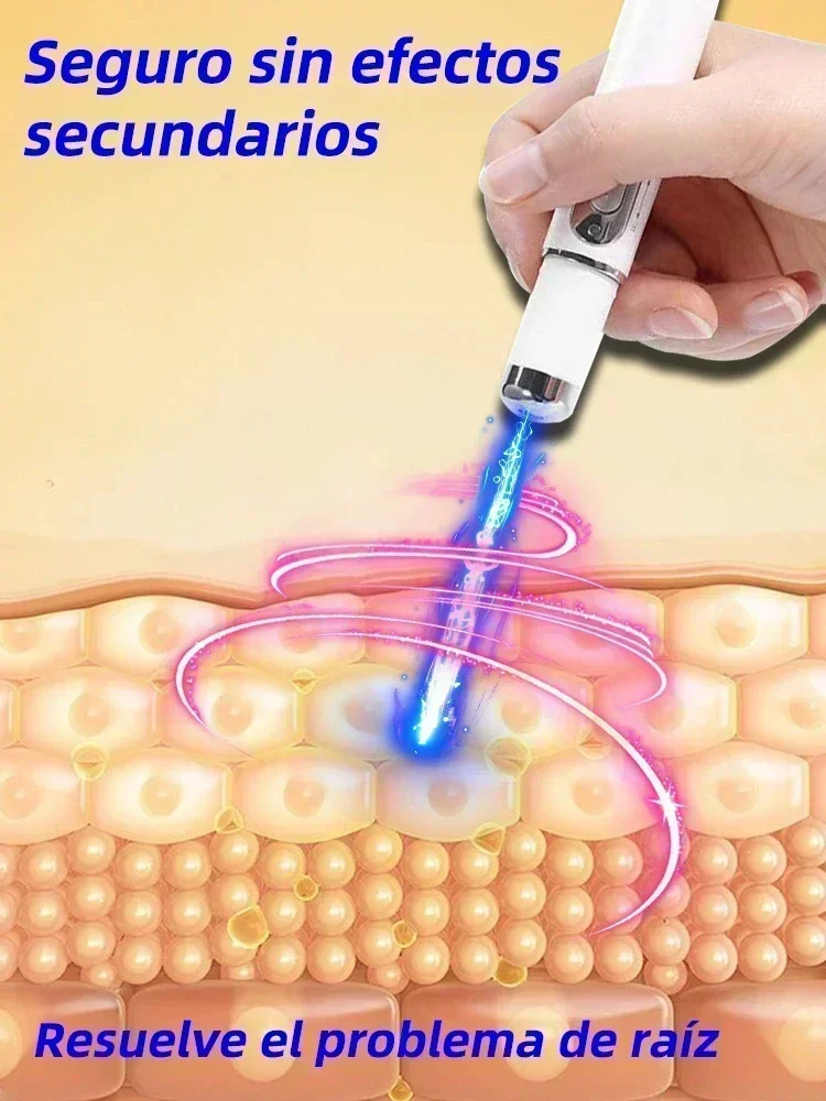 Laser Therapy Keloid Scar Improve Keloid Scar Pen Relief Easy Harmless Laser Pointer