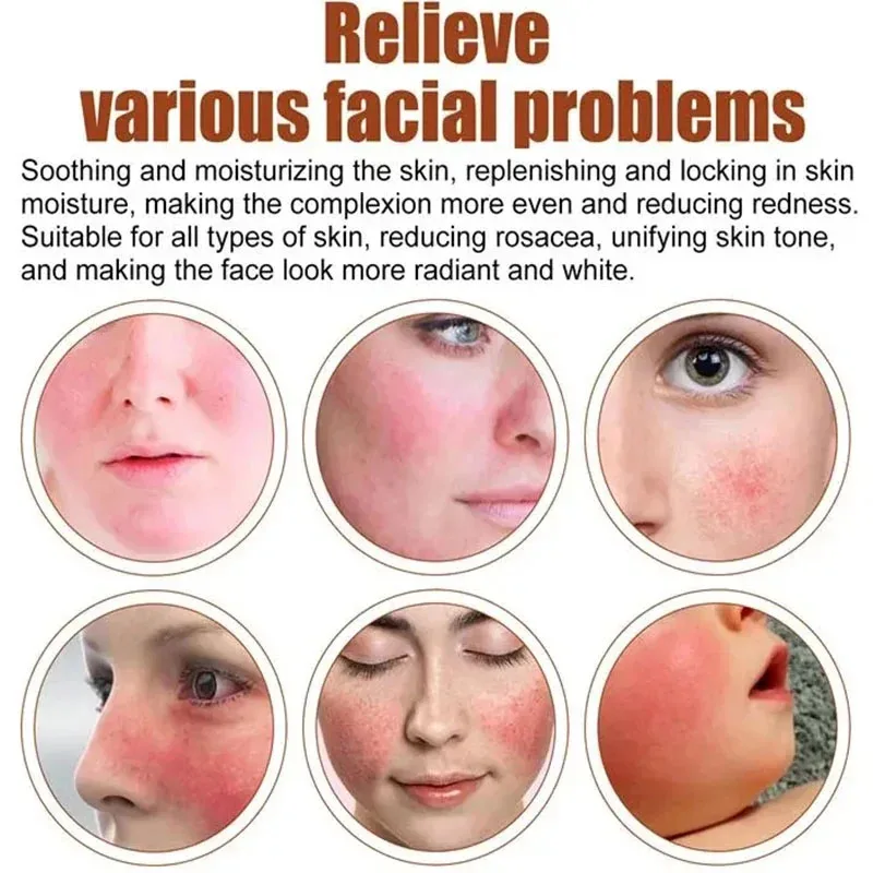 كريم إصلاح احمرار الوجه تحسين جفاف البشرة الحساسة...