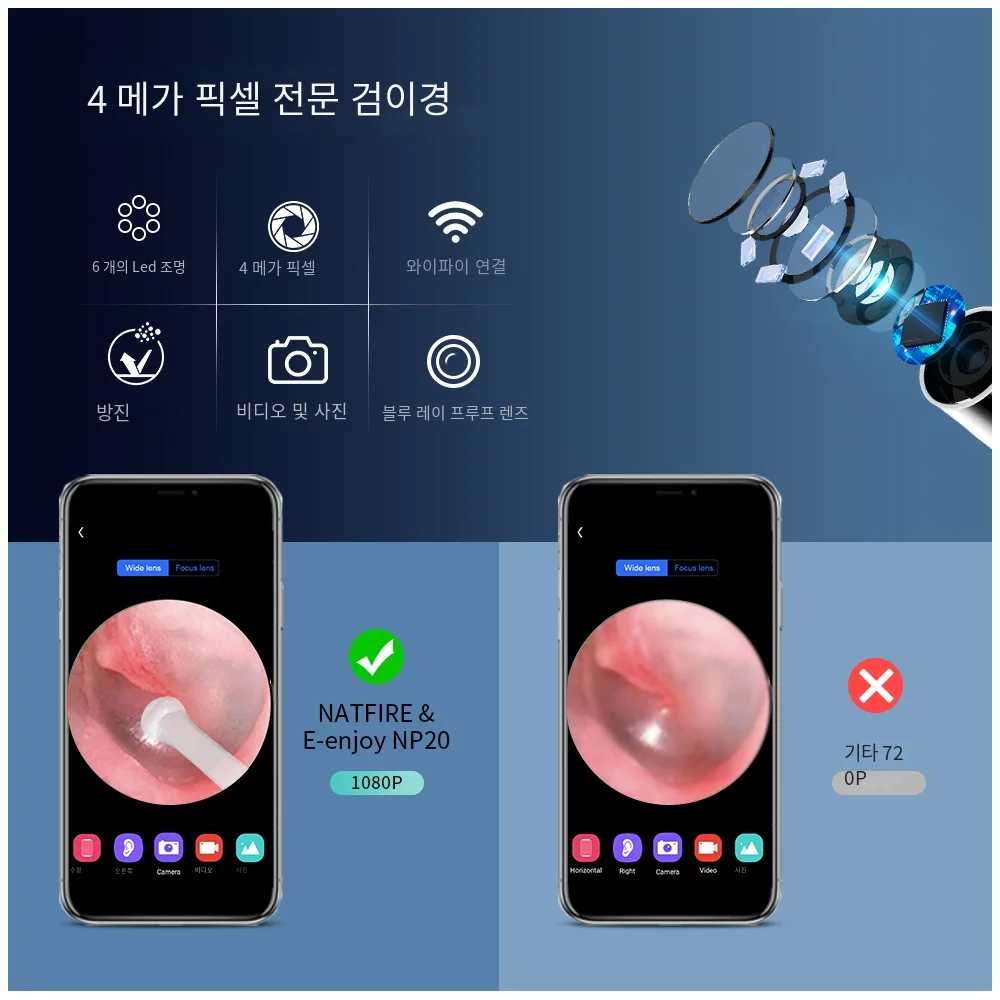 NATFIRE NP20 스마트 귀 클리너 검이경 귀 왁스 제거 도구, 카메라 포함, 귀 내시경 1080P 키트, 아이폰 아이패드 안드로이드용