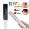 311NM psoriasis Ultraviolet Physiotherapy Instrument Psoriasis Therapy Device White Spot Treatment Light Home Physiotherapy 4