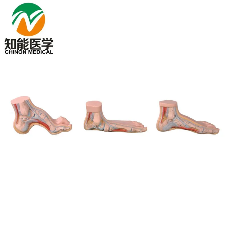 

Стандартная, ровная и луковая ступня