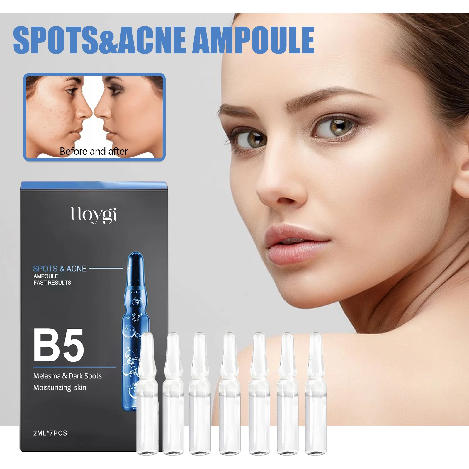 Hoygi Fast Results Dilute Reduce Spots And Acne Refreshing B5 Melasma & Dark Spots Moisturizing Skin Spots & Acne Ampoule 6