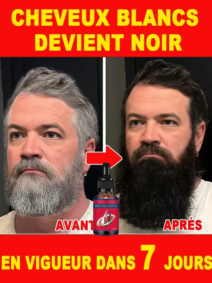 Essence anti-cheveux gris &agrave; base de plantes r&eacute;pare les cheveux gris et donne &agrave; vos cheveux l'apparence d'avoir 20 ans