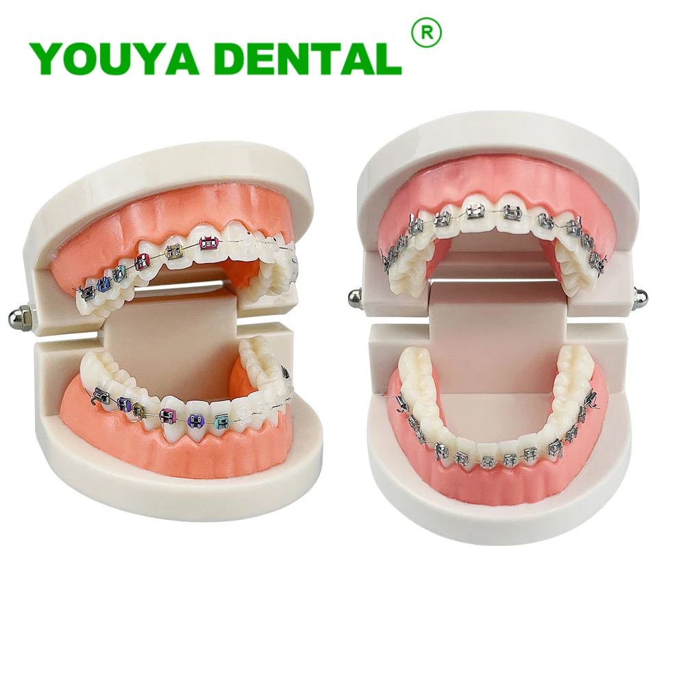 

Dental Orthodontic Typodont Model Teeth Treatment Demonstration Model With Metal Bracket Arch Wire For Dentist Student Study