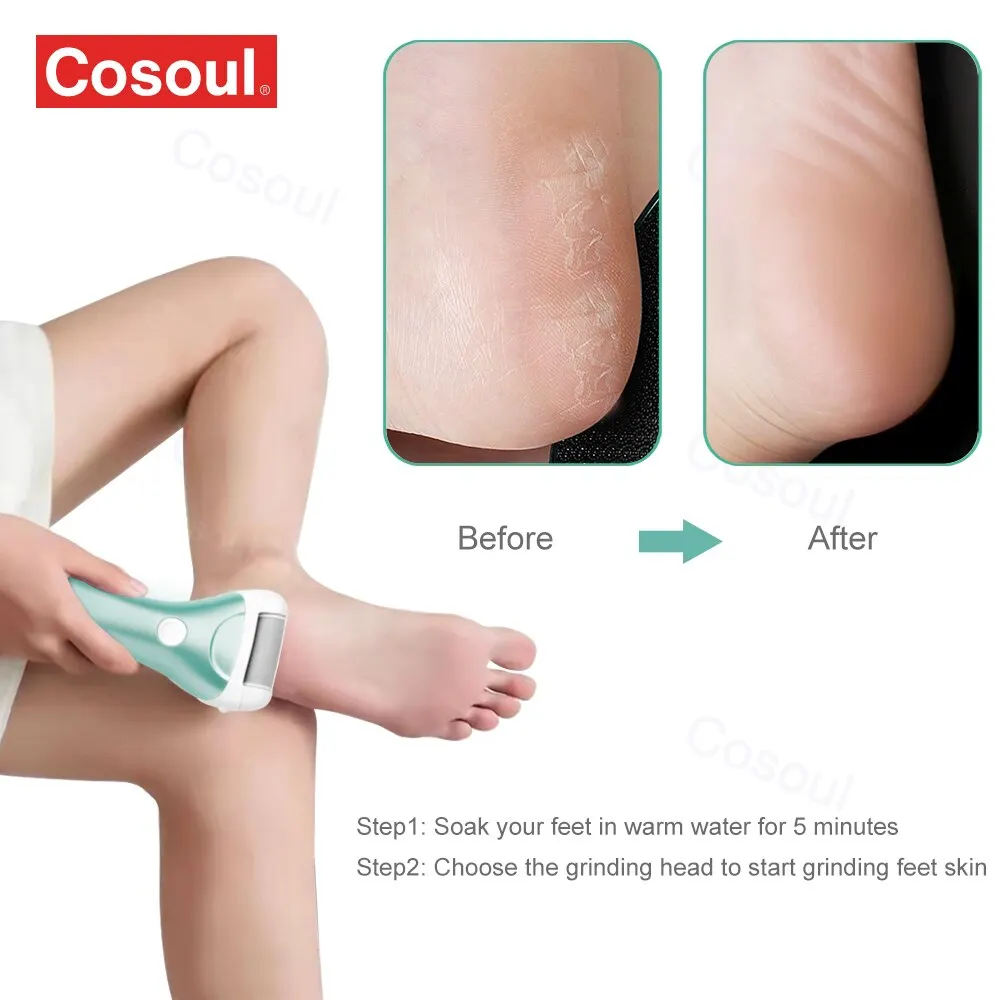 Electric Foot File Pedicure Tools Feet Callus Removers Rechargeable Foot Scrubber Feet Care for Dead Hard Cracked Dry Skin electric foot grinder electric foot file electric foot callus remover