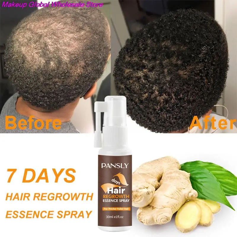 TurmericHairGrowthSprayEssentialOilsHairLossTreatmentPreventHairDryFrizzyDamaged