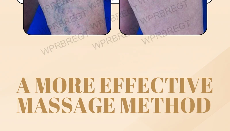 Pulse Massage Patch Eliminates Varicose Veins And Effectively Improves Blood Circulation_voghion.com