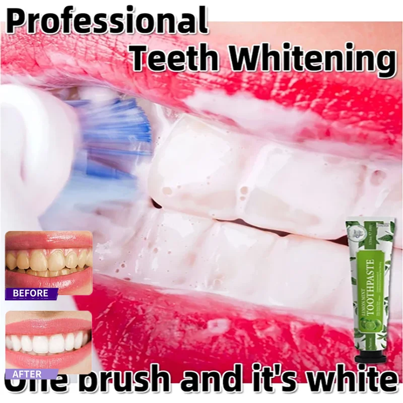 

100g Remove Yellow Teeth Cleaning Bad Breath Plaque Tooth Stain Remover Dental Calculus Toothpaste Whiten Prevent Periodontitis