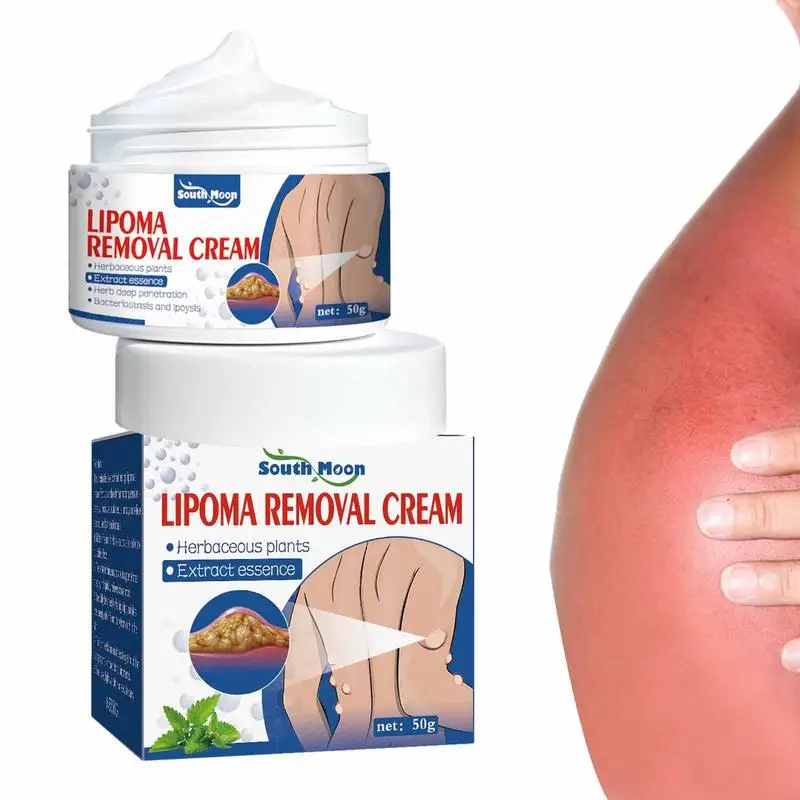 lipoma-ointment-reduces-inflammation-removal-lipoma-get-rid-of-your