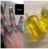 Dark knuckles remover Oil 1