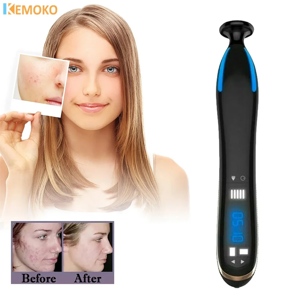 Home Beauty Device Anti Acne Cleaning Ozone Plasma Skin Rejuvenation Care Facial Beauty Device Caneta Jato De Plasma Hifu