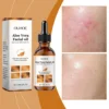 Aloe Vera Facial OilFacial OilFacial Serum 1