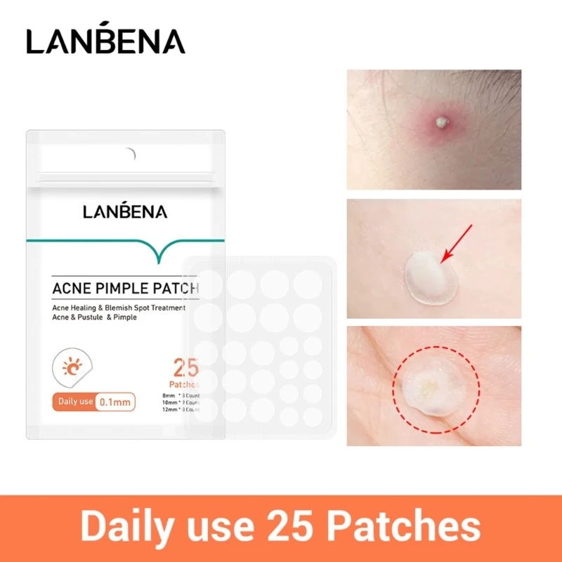 Acne stickers acne pimple patches acne removing invisible sticker remover mask patches day/night use skin care