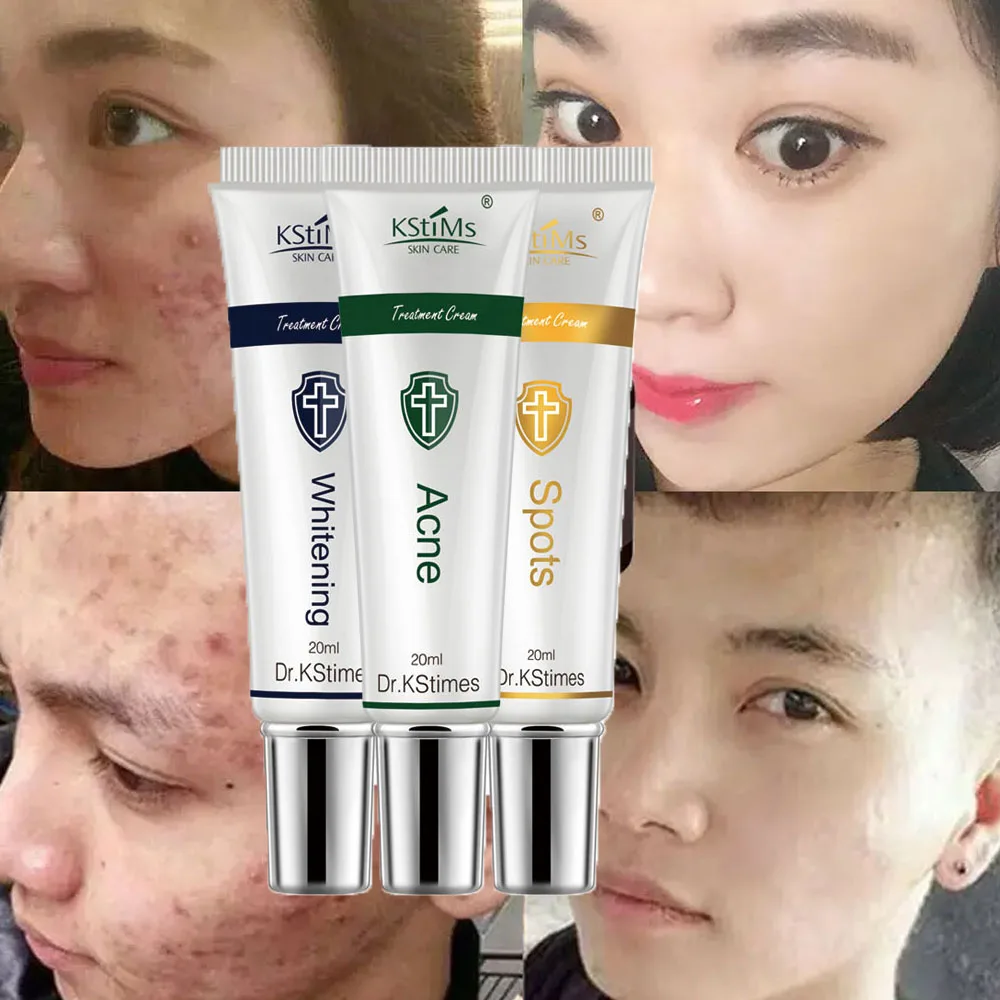 Korea Against Face Acne Oinment Pimple Remedy Anti Acne Treatment Cream for Acne Remover with Aloe Vera Tea Tree Oil in 3 Days