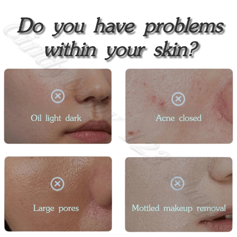 Salicylic Acid Vitamin B5 Facial Cleanser Oil Control Blackhead Exfoliating Deep Cleansing Acne Shrinking Pore Cleanser 100g 5