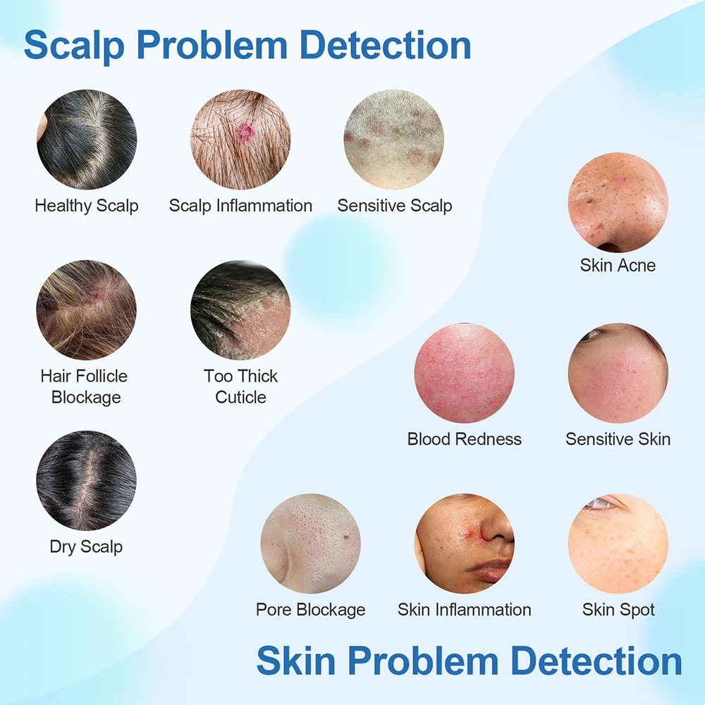 Handheld Hair Follicle Scalp Detector 4X Magnifying Pore Magnifier Facial Skin Tester Analyzer Hair Scalp Diagnostic Machine