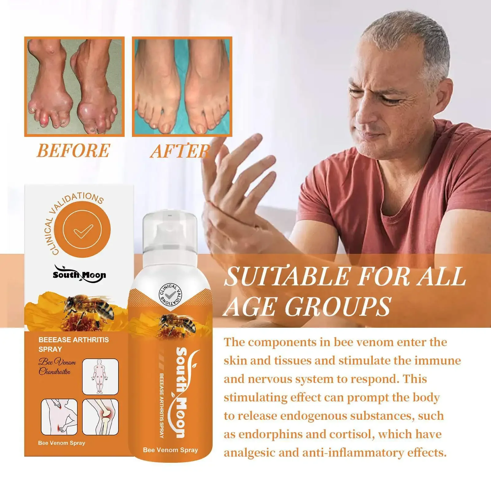 Pain Relief Cream Bee Venom Arthritis Spray Anti-Inflammatory Bone Therapy Muscle Ache Relief Treat Meniscus Sprain Medical Joint Analgesic Spray