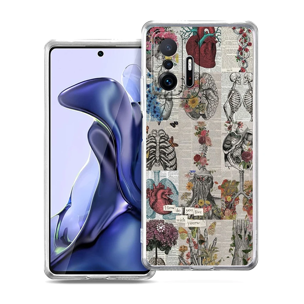 Transparent Soft TPU Shell with Anatomy Skeleton Chalkboard Heart Design