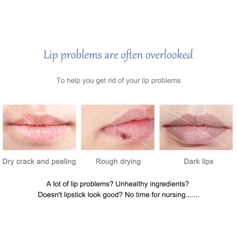 Remove Dark Lip Balm Lighten Melanin Long Lasting Nourishing Waterproof Lip Mask Lip Moisturizing Anti-dry Lip Care Products 5