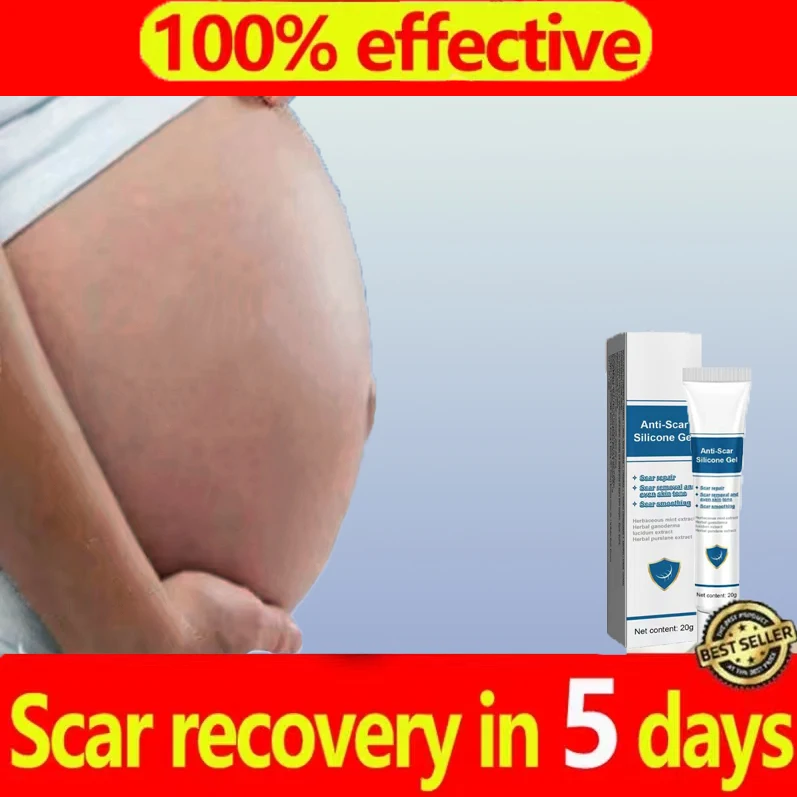 Stretch Marks Cream For Pregnancy Stretch Marks Removal Eliminate Red White Old Stretch Marks Oil