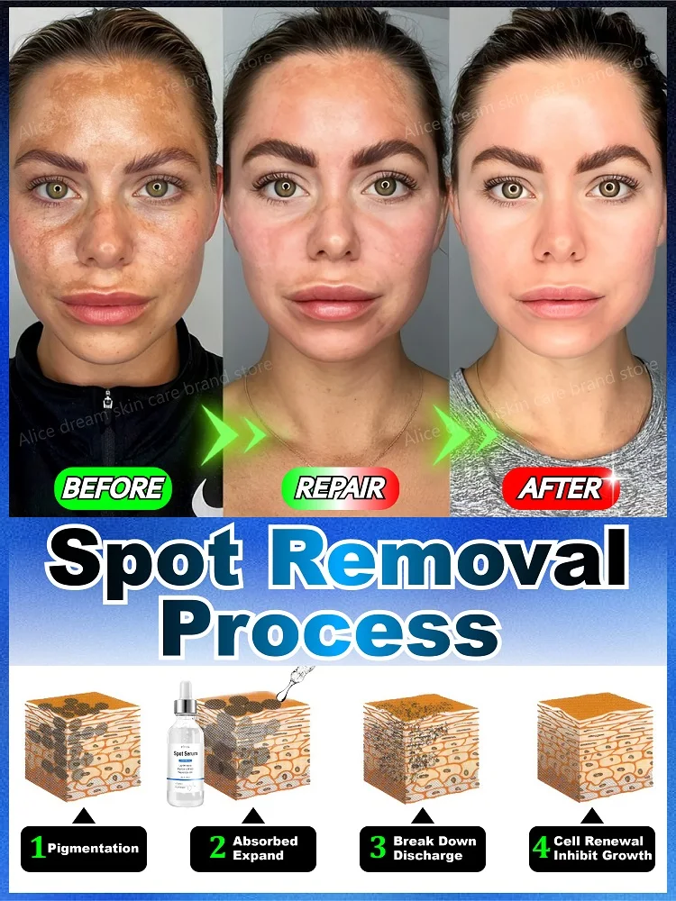 Effectively solves all pigmentation symptoms 5