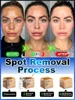 Effectively solves all pigmentation symptoms 5