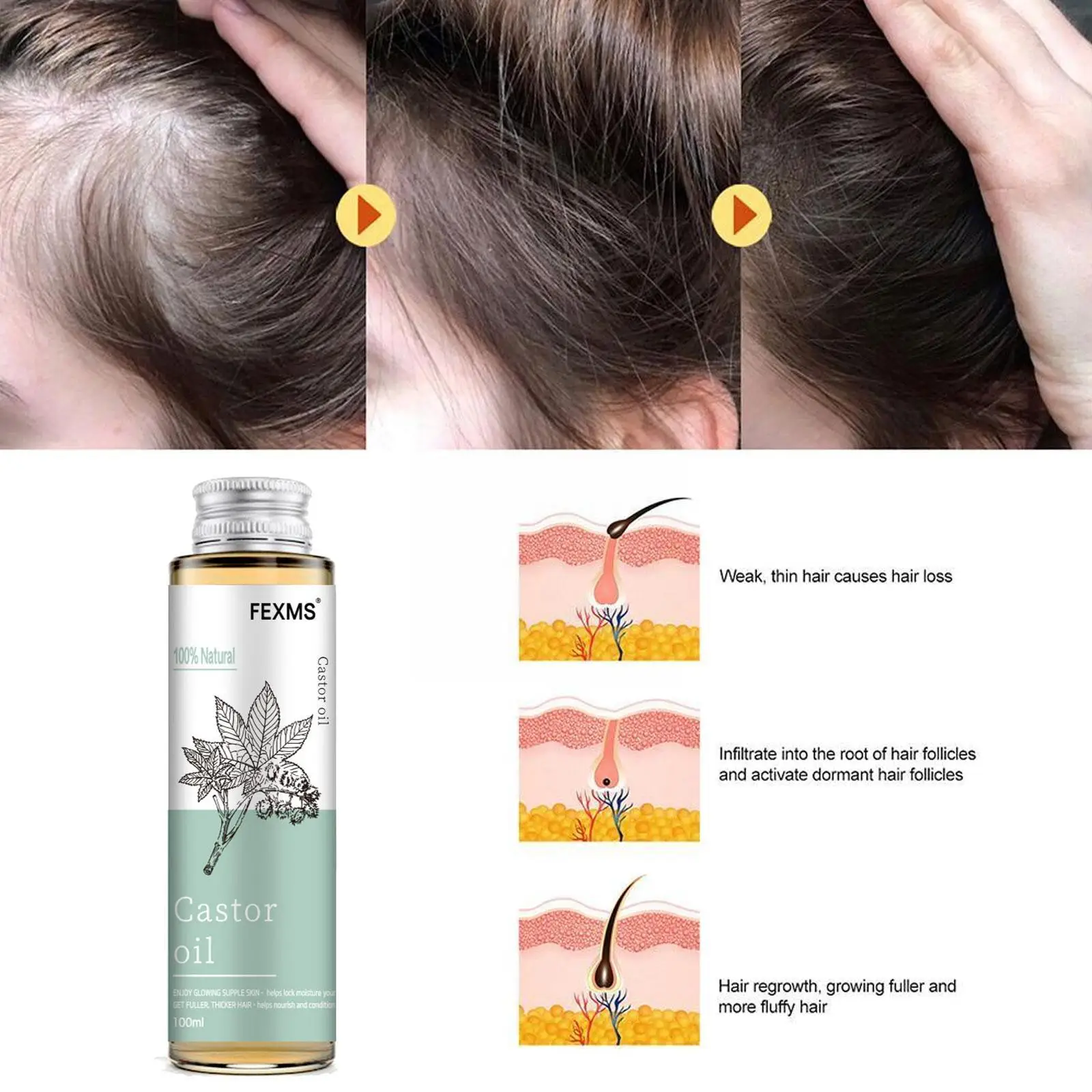 Рисунок 5 - Чистое и касторовое масло для роста волос