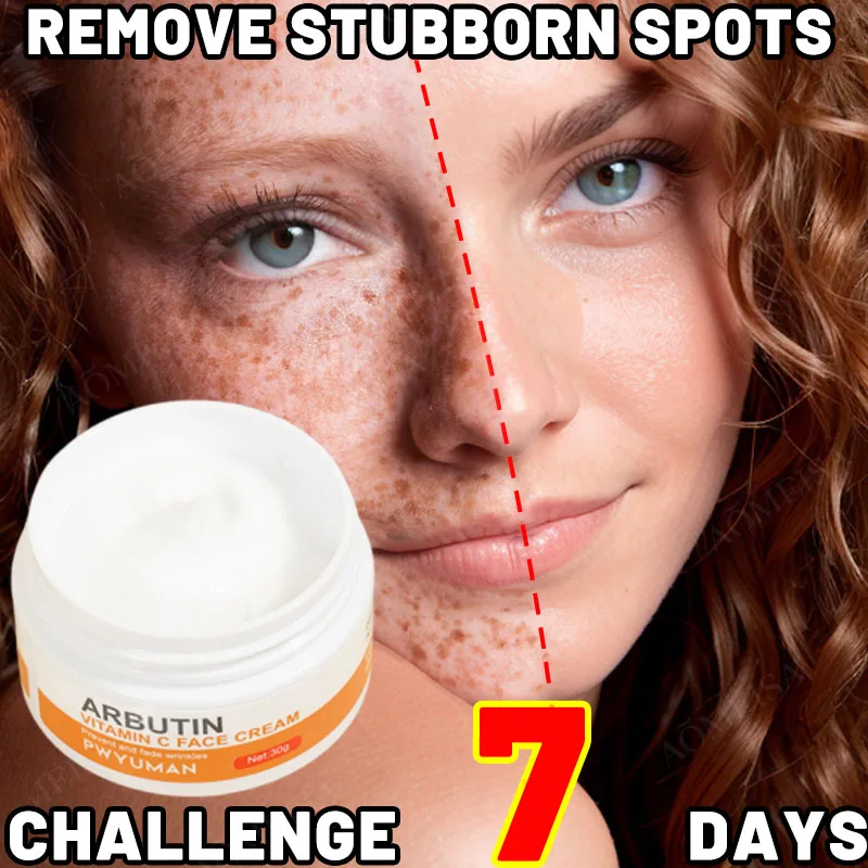 

Vitamin C Whitening Anti-Freckles Face Cream Remover Dark Spots Fade Melasma Melanin Anti-Aging Brighten Moisturizing Skin Care