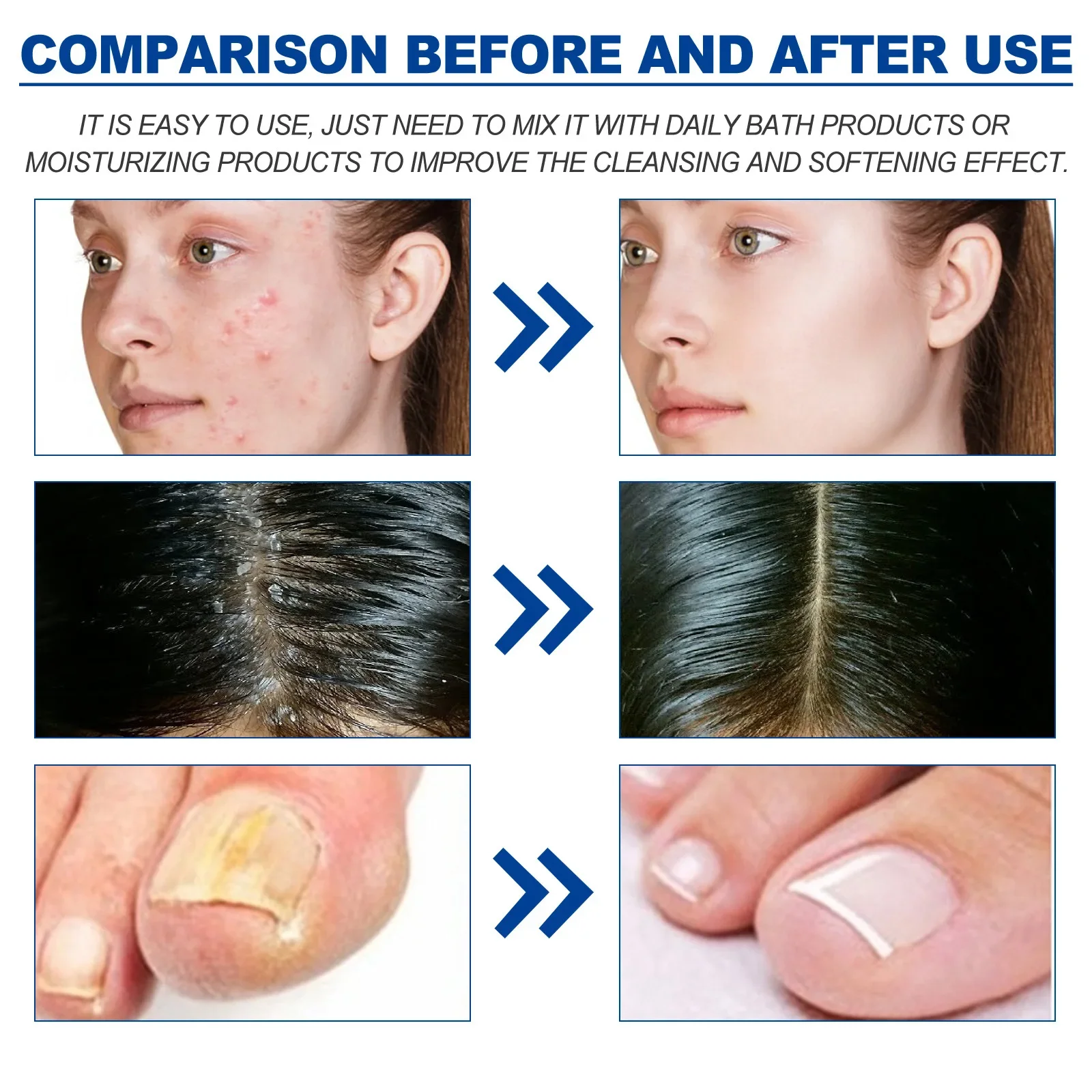 100ml Eelhoe Essential Tea Tree Oil Hair Repair Deep Moisturizing Facial Skin Hydrating Soft Hair Care Multi-Effect Essence 6