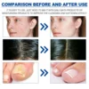 100ml Eelhoe Essential Tea Tree Oil Hair Repair Deep Moisturizing Facial Skin Hydrating Soft Hair Care Multi-Effect Essence 6