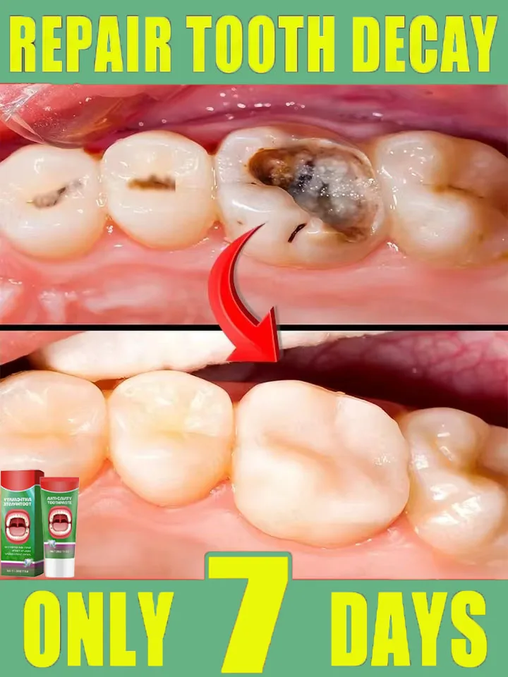 Prendre soin des dents, r&eacute;parer le lit dentaire, rafra&icirc;chir l'haleine, optimiser la bouche