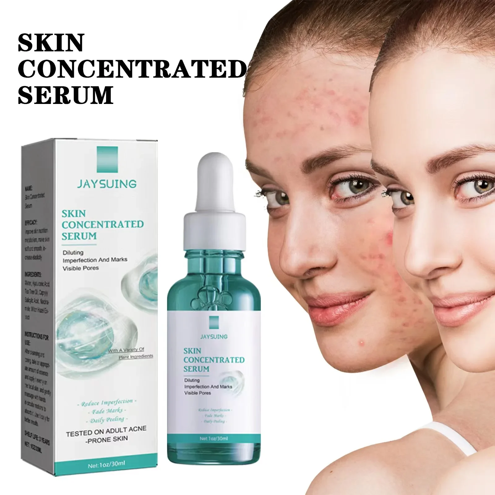 

30ml Skin Concentrated Serum Face Oil Control Shrink Pores Remove Marks Moisturizing Hydrating Facia Repair Serum Skin Care