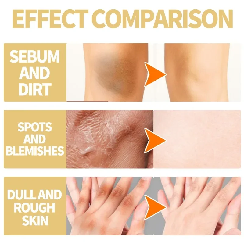 Yellow peeling oil exfoliating elbow knee Deep cleaning Bleaching fade Dark spots melanin brighten skin whiten Remove Dead skin whitening cream body scrub body peeling lotion