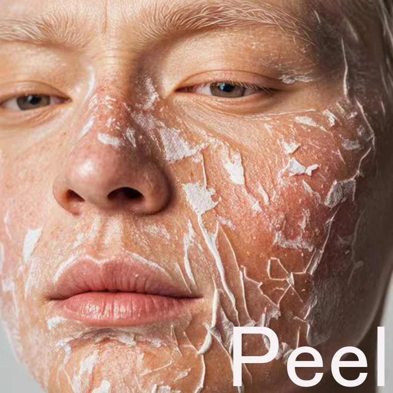 TCA20 30 35 40 50 60 70 peel Keratin 5ml male female salon skill original strength