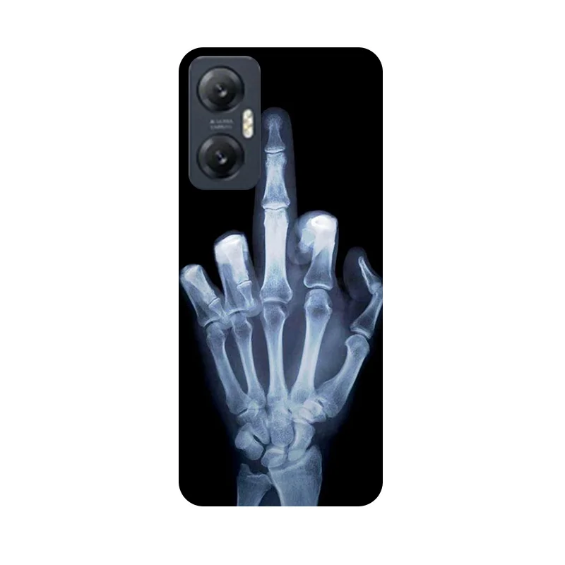 Shockproof TPU Bumper Soft Silicone Phone Case with Painted Design