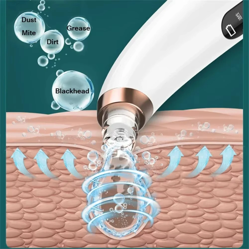 Electric Blackhead Small Bubble Blackhead Remover USB Water Cycle Pore Acne Pimple Removal Vacuum Suction Facial Nose Cleaner 3