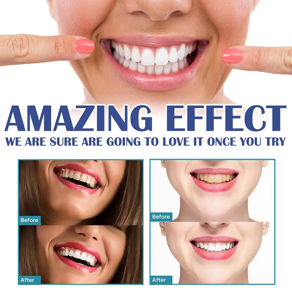 

Gum Soothing Gel Relieve Mouth Sores Blisters Periodontal Pain Clean Antibacteria Care Pharyngitis Gum 4ml Treatment Oral V7H7