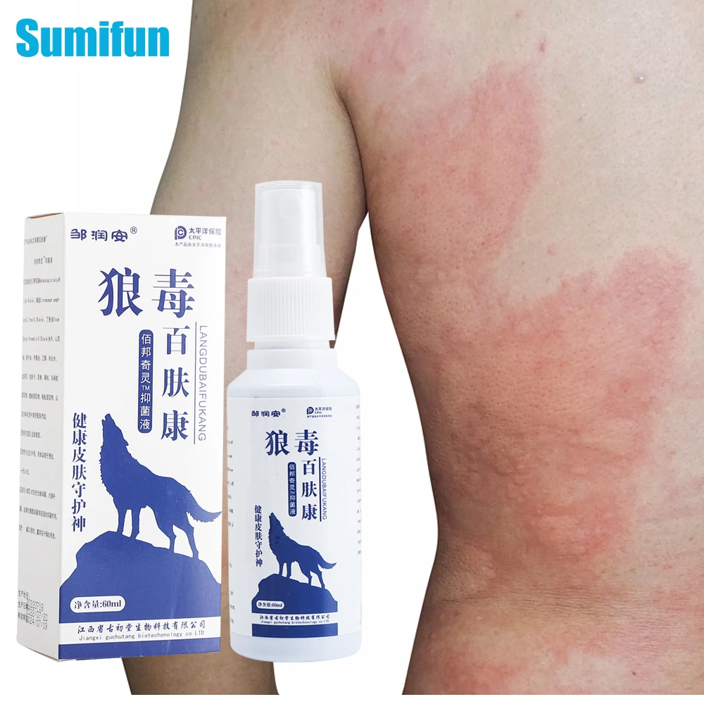 

Искусственное лечение, искусственная экзема, средство для борьбы с кожей, противогрибковое лечение, Прямая поставка