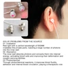 Tinnitus Ear Laser Therapy Portable Otitis Media Deafness Tinnitus Physiotherapy Relief Device 650nm Red Light LLLT Ear Canal 4
