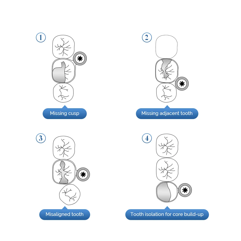 Рисунок 2 - BAISTRA стоматологические матричные