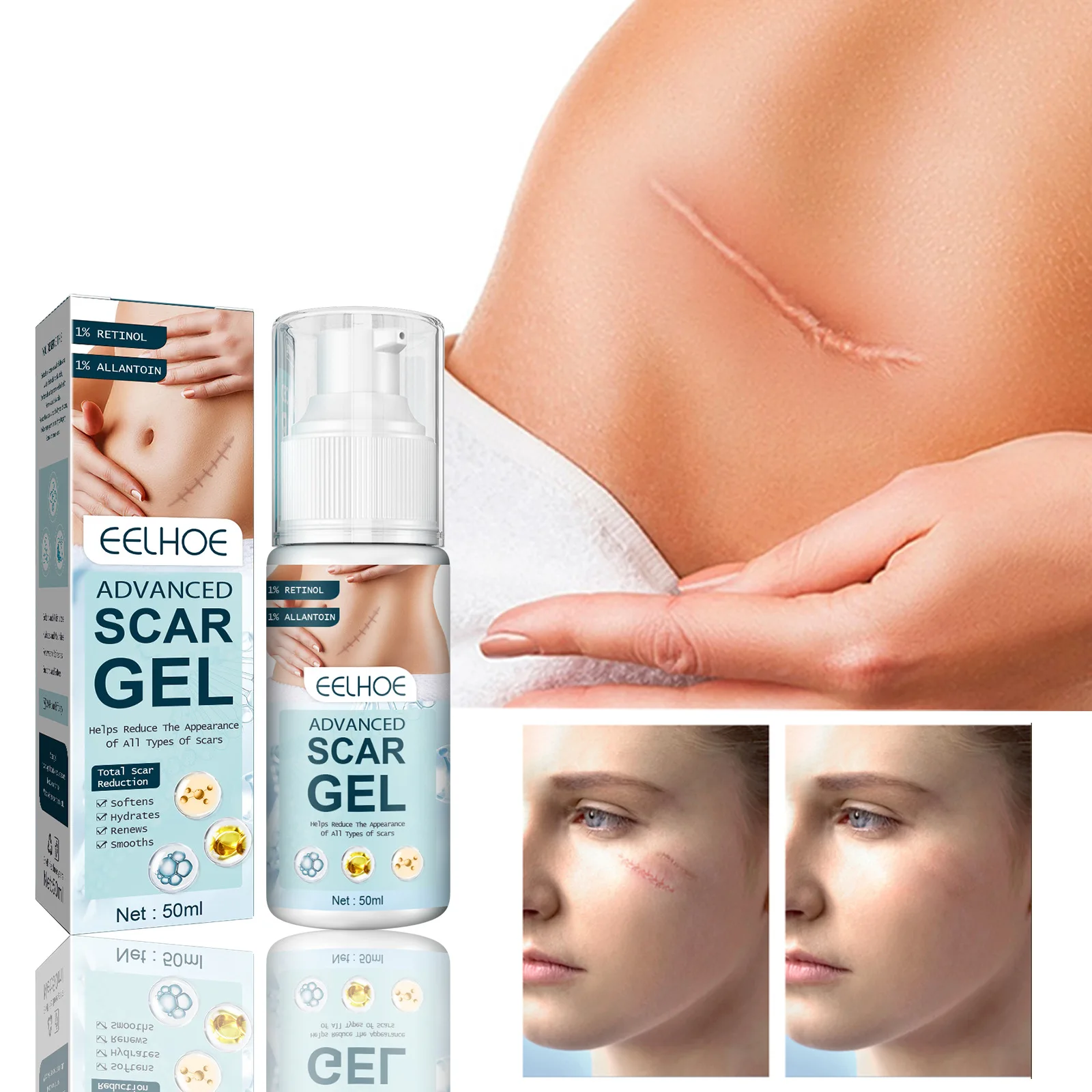 

Soften and Brighten The Skin, Dilute Scars, Skin Hyperplasia, Burns, Caresses Scars, Smoothes and Repairs Scars Gel Cream