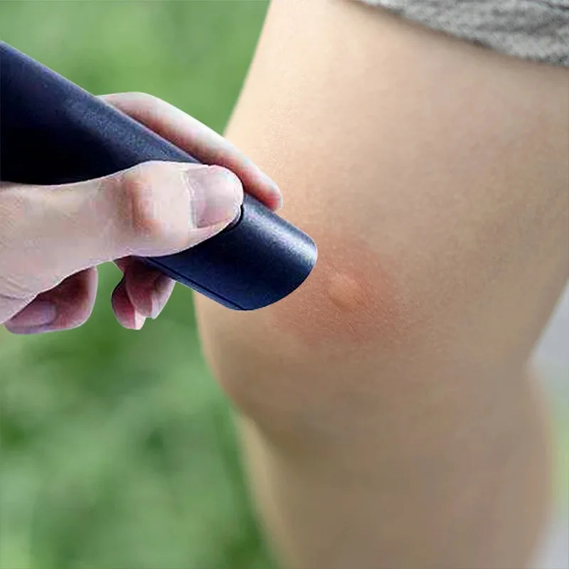 Portable Itch Relief Pen 2