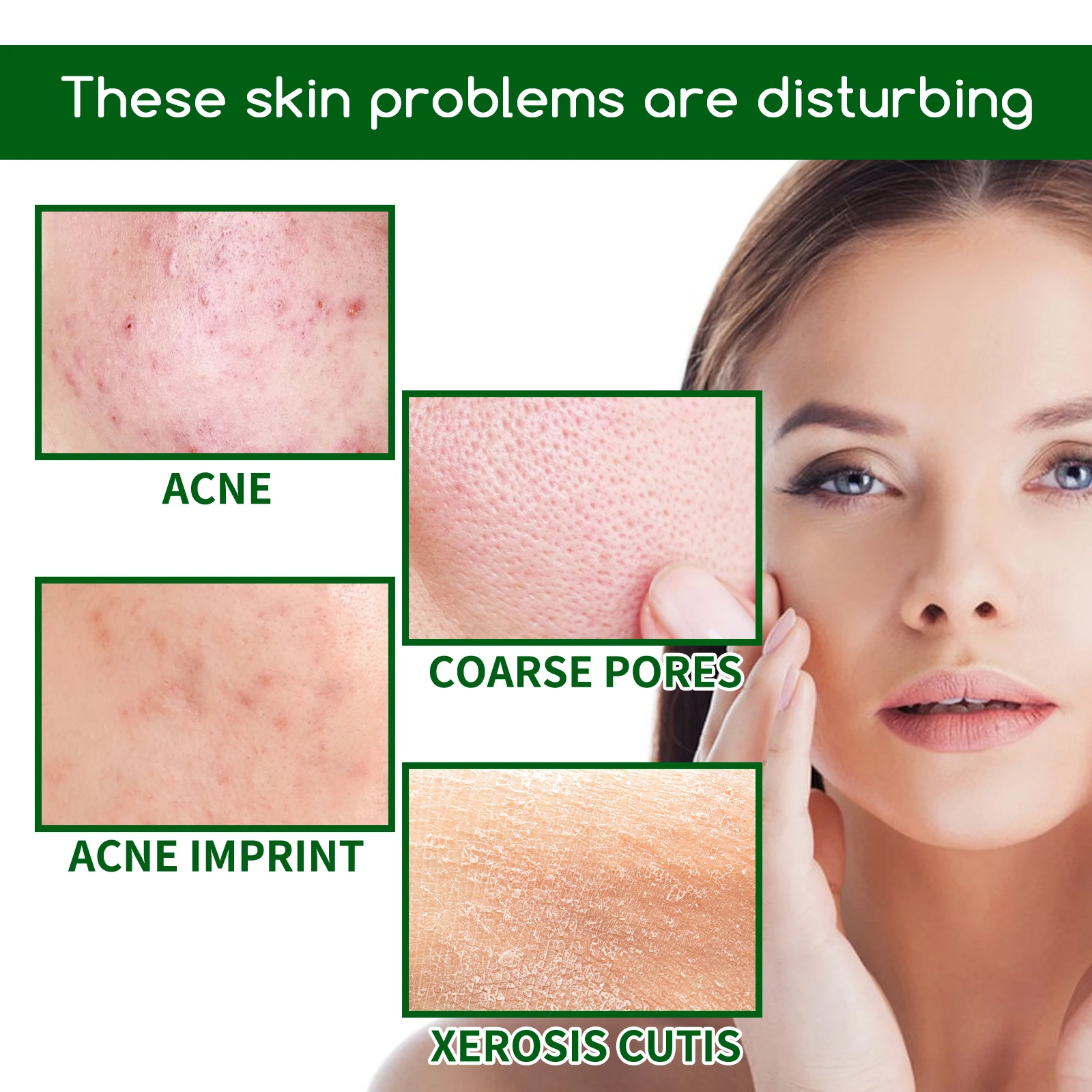 Salicylic Acid Acne Removal Face Serum Pimple Treatment Anti Blackhead Oil Control Shrink Pore Soften Facial Moisturizer Essence 3
