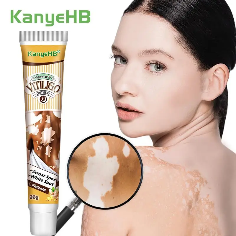 

1Pcs Vitiligo Ointment Chinese Medical Mycosis Leukoplakia Inhibit Fungi Anti-itch Relieve Pain Skin Dry Treatment Cream G041