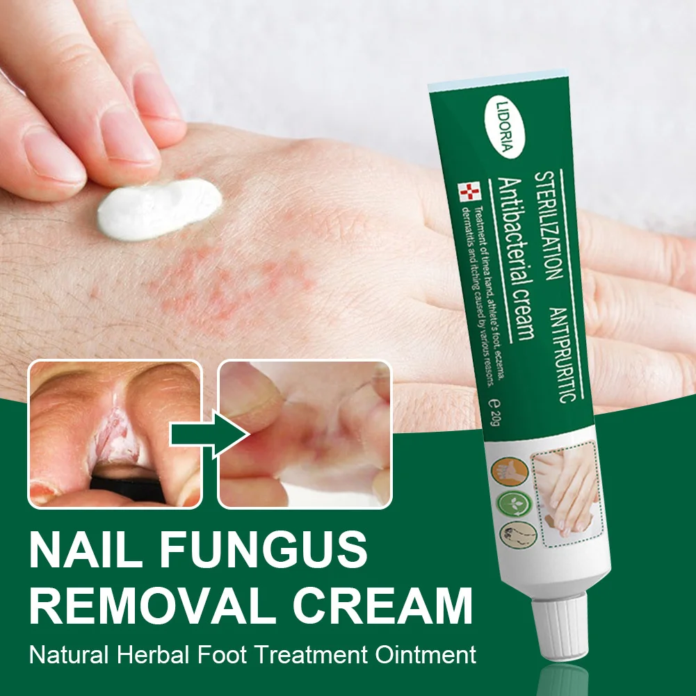 Herbal Foot Cream Anti Fungal Infection Foot Treatment Ointment Itch