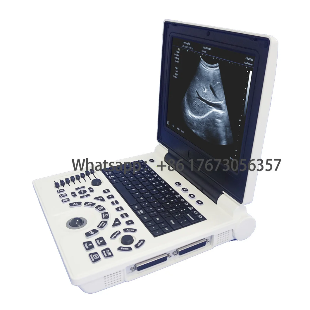 

Manufacture Price CW Function Window Based Portable Laptop Doppler Ultrasound hine
