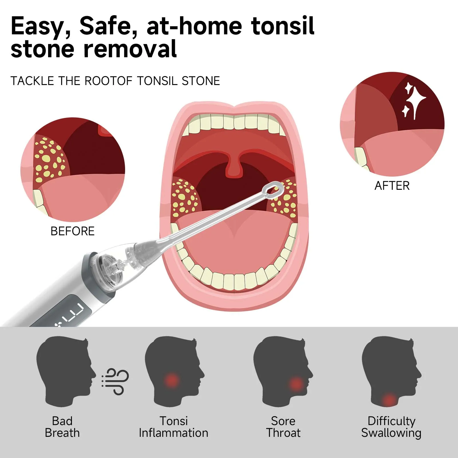 Vacuum Tonsil Stone Remover Tool Built-In LED light  8 Suction Modes Anti Bad Breath Oral Irrigator&Tongue Coating Scraper 2
