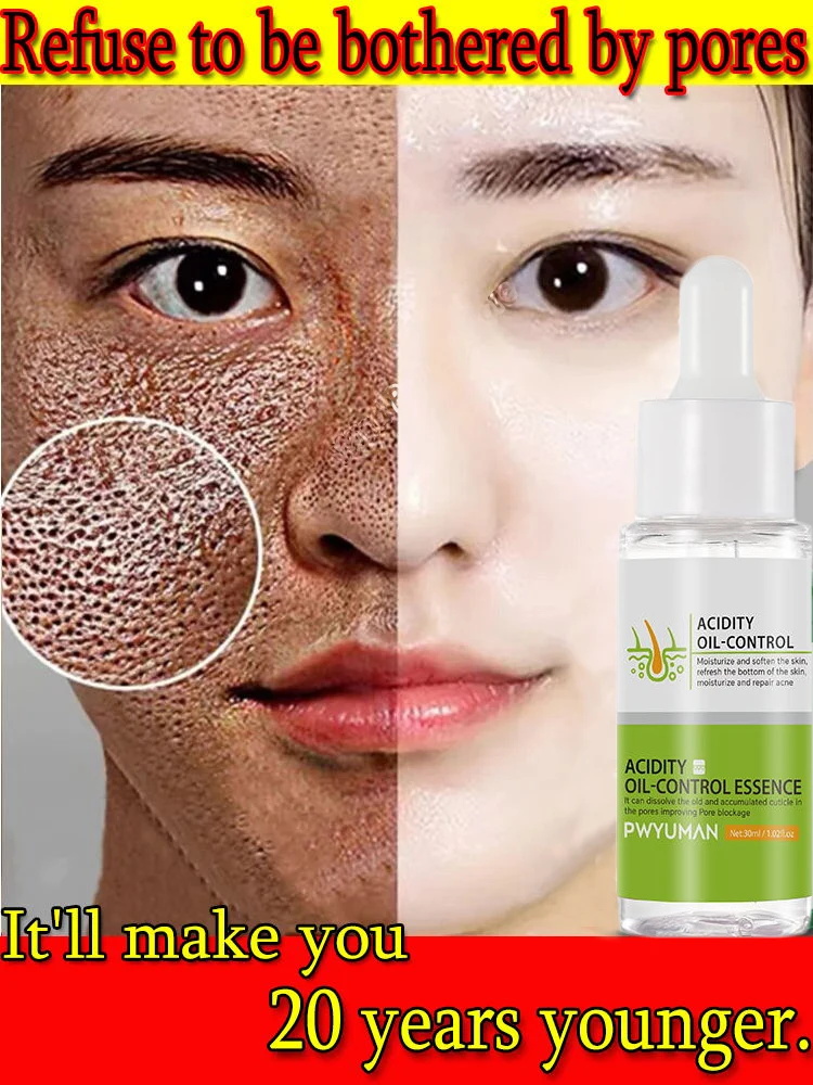 

Shrink Pores Serum Oil Control Moisturizing Nourish Smooth Pores Repair Essence Improve Acne Whitening Firm Facial Skin Care 30G