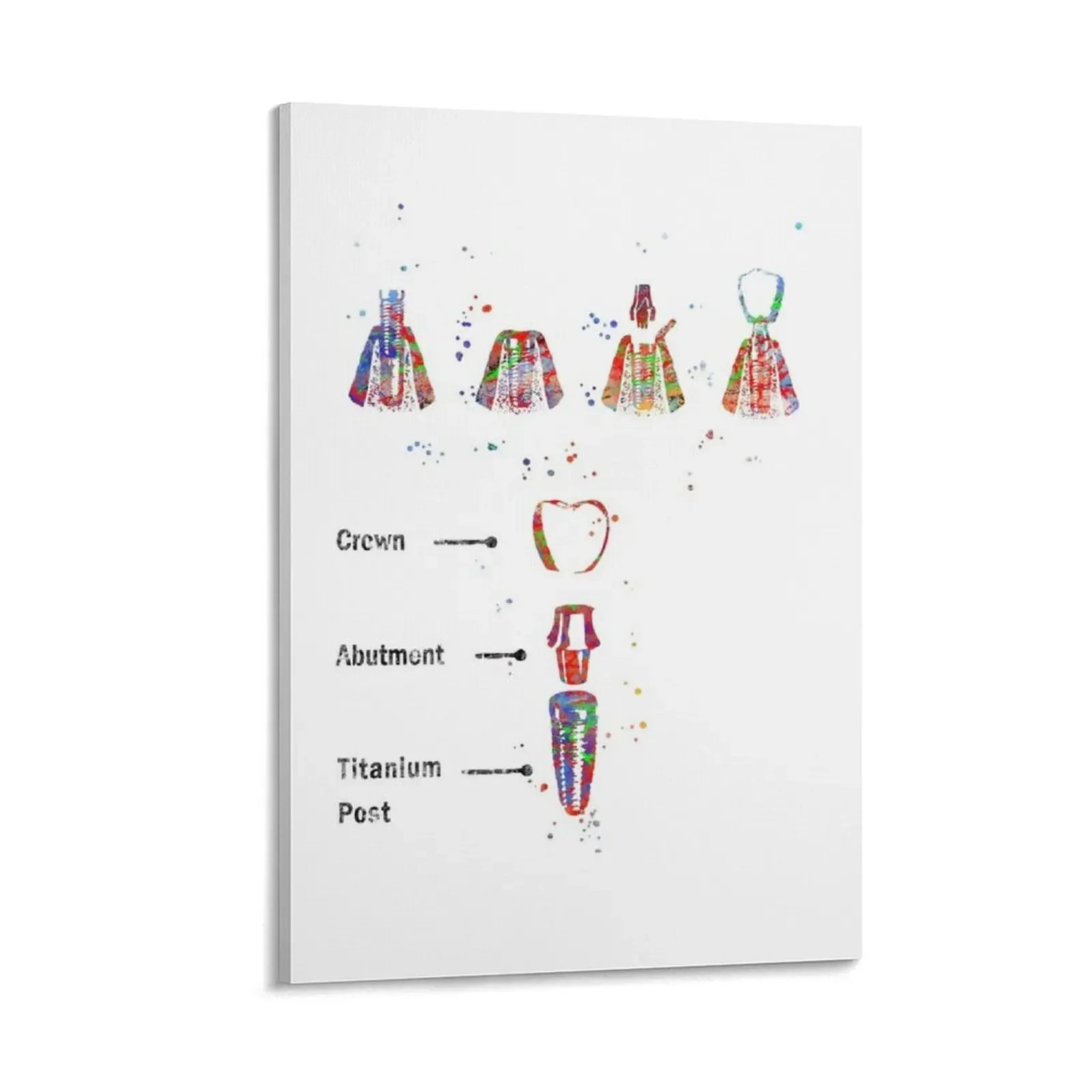 

Dental implant procedure, dental anatomy, dental implant Canvas Painting home decor interior aesthetic room decoration