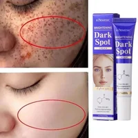 Amino Acid Freckle Whitening Cream Fade Pigmentation Melasma Dark Spots Corrector Repair Cream Korean Skin Care
